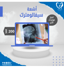 أشعة سيفالومتريك