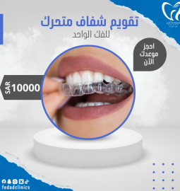 تقويم شفاف متحرك (للفكين)