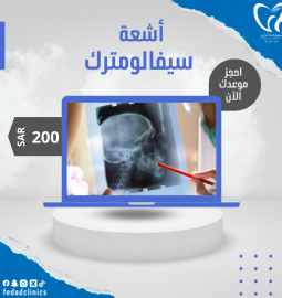 أشعة سيفالومتريك