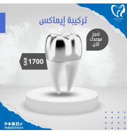 تركيبة ايماكس