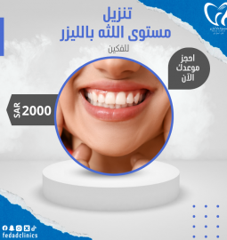 تنزيل مستوى اللثه  بالليزر (فكين)