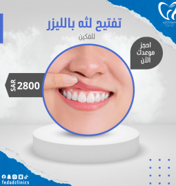 تفتيح اللثه بالليزر (فكين)
