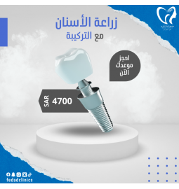 زراعة اسنان مع التركيب
