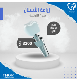 زراعة اسنان بدون التركيبه