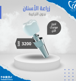 زراعة اسنان بدون التركيبه