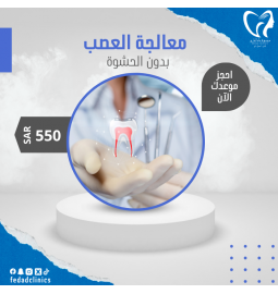 معالجة عصب بدون حشوة