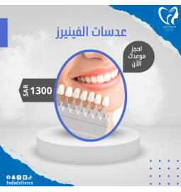 عدسات الفينيرز