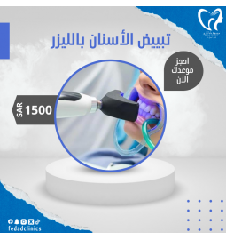 تبييض أسنان بالليزر